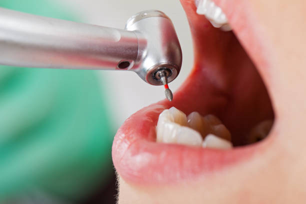 Best Weekend Emergency Dentist in Henrietta, TX